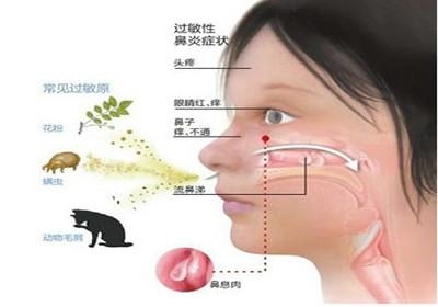 小儿过敏性鼻炎有何危害