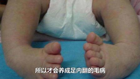 一岁宝宝足内翻怎么办