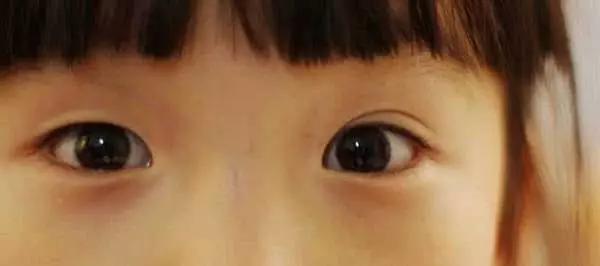 单眼皮宝宝长大会变成双眼皮吗