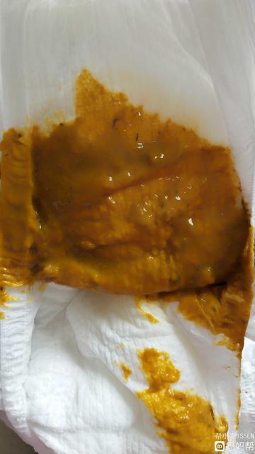 纯母乳喂养的宝宝几个月添加辅食