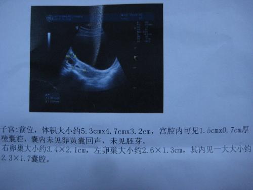 怀孕40天药流安全吗疼吗