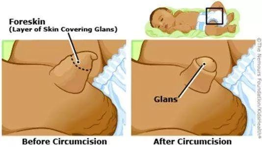 宝宝总是摸小鸡怎么回事