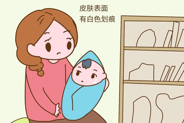 小宝宝缺水有哪些表现
