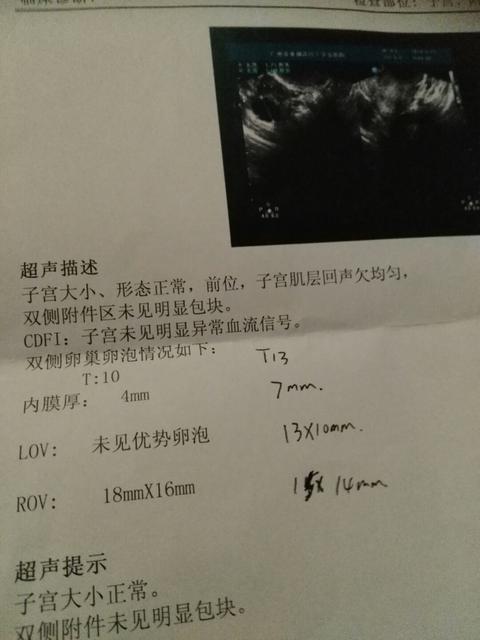 卵泡发育不好怎么回事啊