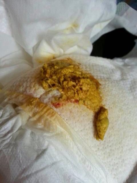 宝宝好几天没有拉大便了怎么办