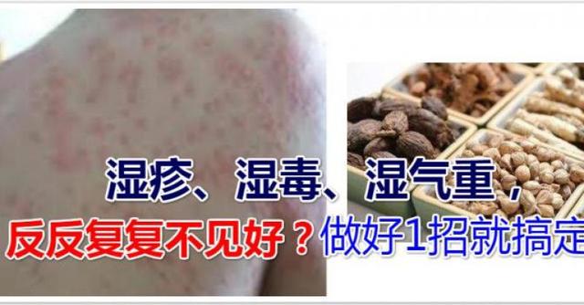 长湿疹是因为湿气太重吗