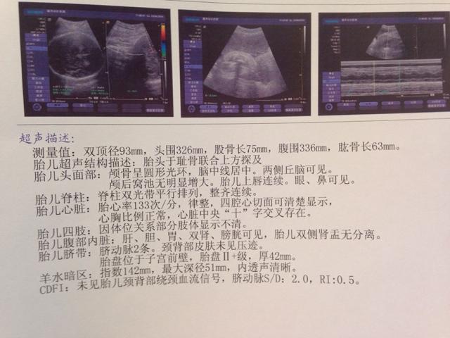 孕38周胎儿双顶径标准