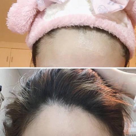 抖音同款修发际线填充神器修容阴影粉大额头修补遮发髻线防水补发