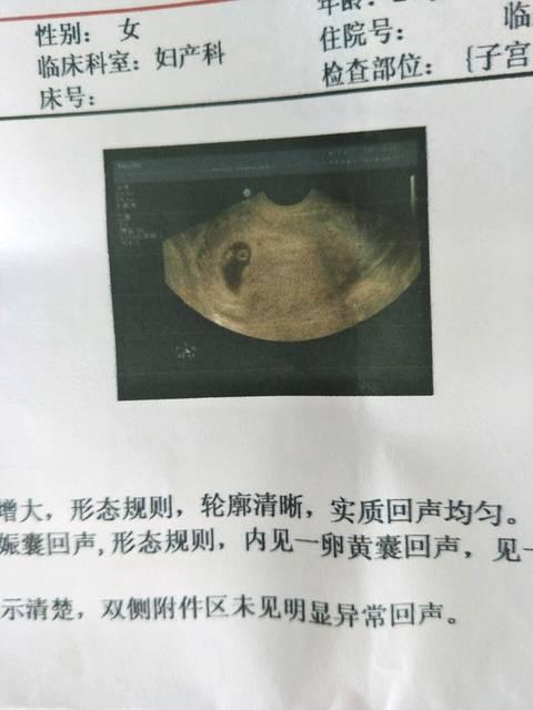 清宫表该怎么看