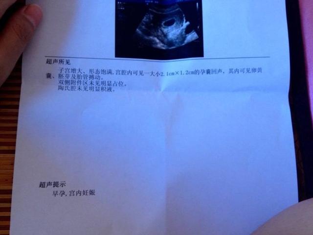 七种科学方法有助生儿子