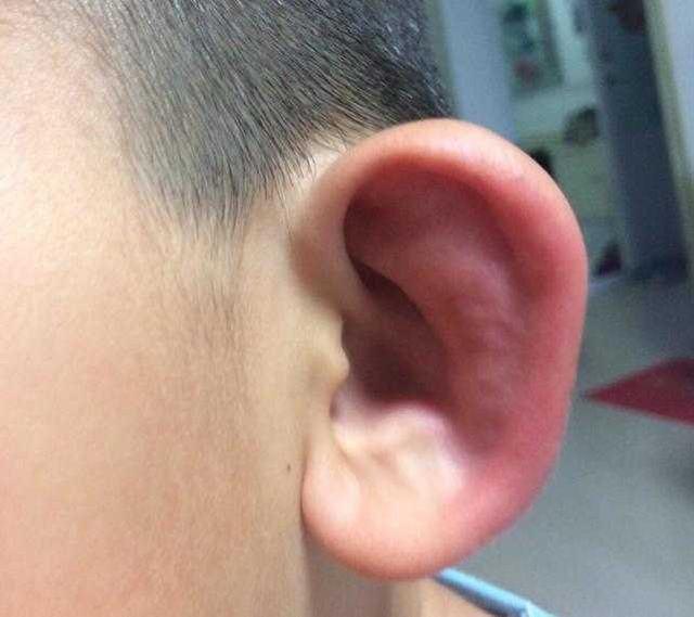 宝宝夏日如何避免蚊子叮咬