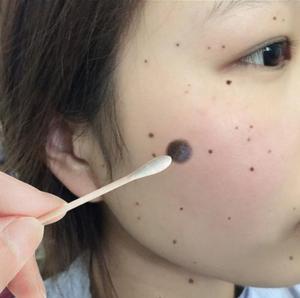 【去黑点神器买2送1】抖音同款净颜洁面玫瑰精油男女通用