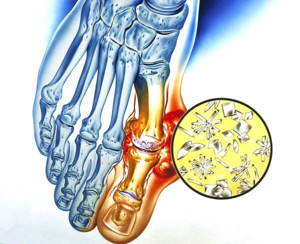 这些食物不能吃PPT