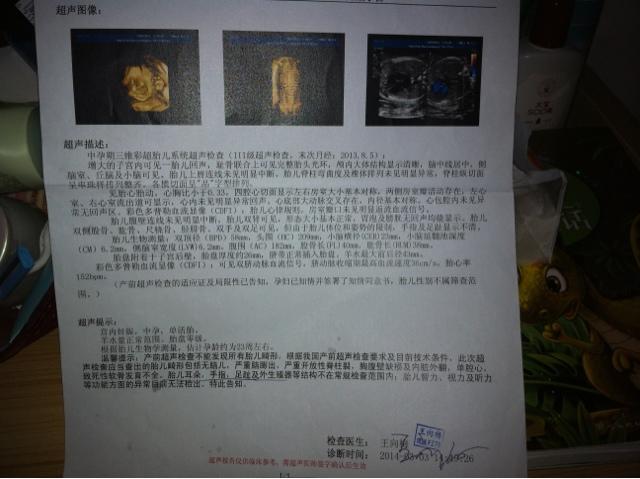 孕晚期需要进行体重管理吗