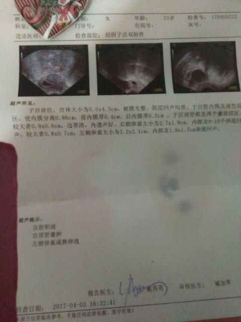 做b超监测卵泡需要多少钱