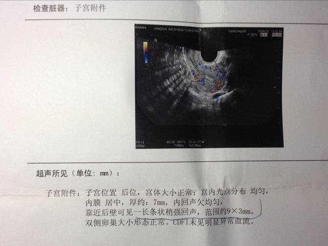 女人生三胎不能超过多少岁
