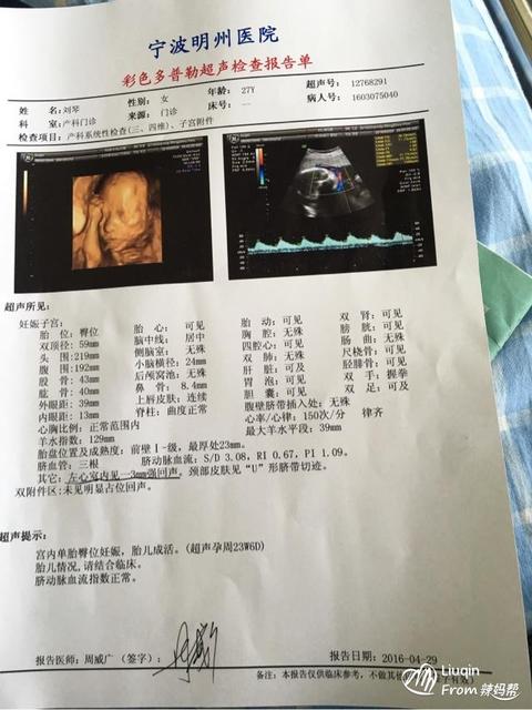 胎儿心脏有强光点要紧吗