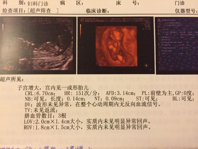 nt检查最佳时间是什么时候?