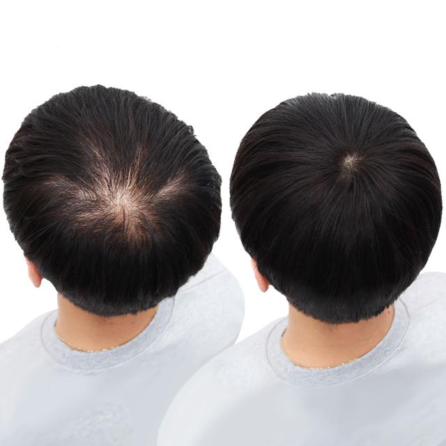 3岁宝宝头发稀少怎么办