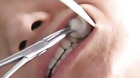 11口腔护理技术常用50项护理操作技术