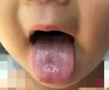 宝宝脾虚的推拿手法