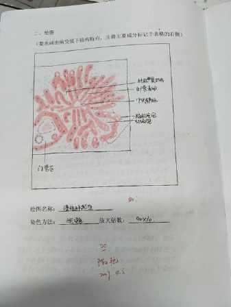 肝淤血红蓝铅笔手绘图