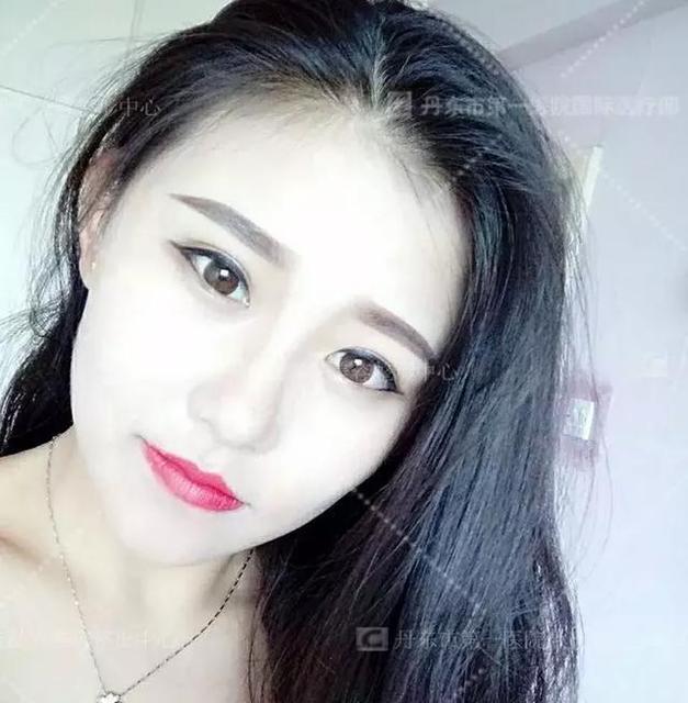 新生儿多久可以看出双眼皮?