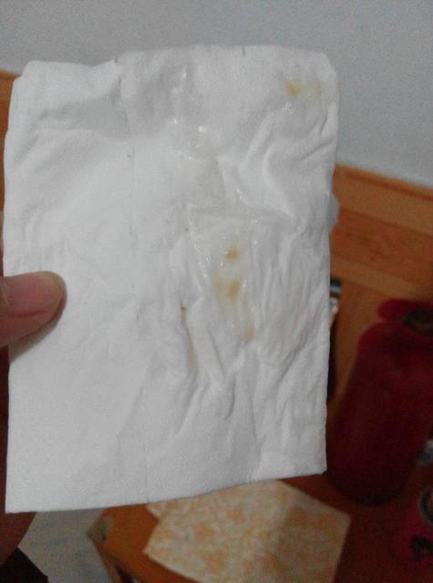 试管婴儿能避免宫外孕吗