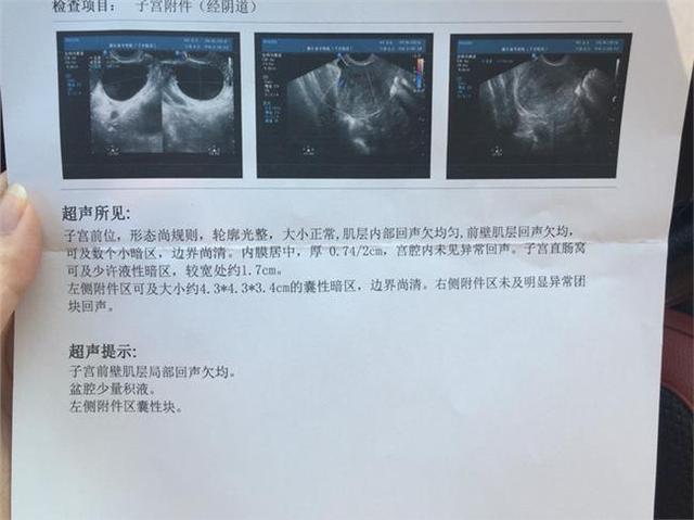 怀孕b超检查有子宫肌瘤怎么办