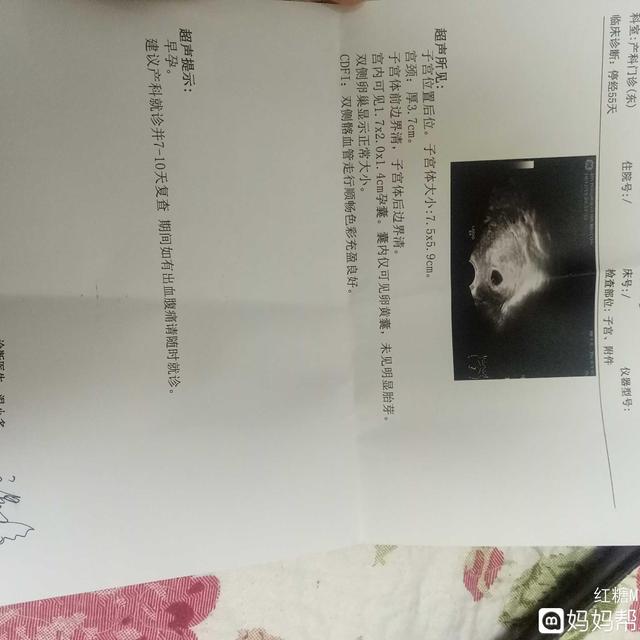 没有排卵的原因是因为怀孕了吗