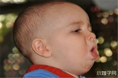 孩子常见咳嗽的原因