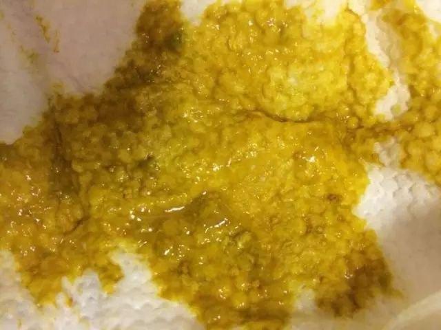 秋季宝宝腹泻怎么办？最佳方法在这