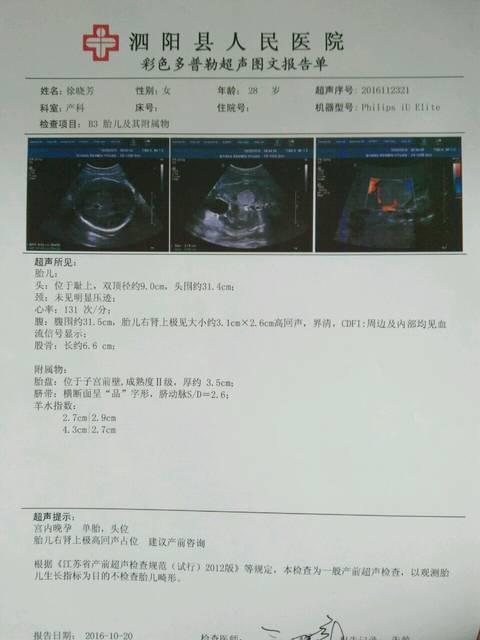 孕晚期做产检需要问哪些问题