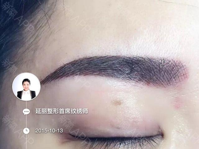 自然产的宝宝比较不会过敏吗