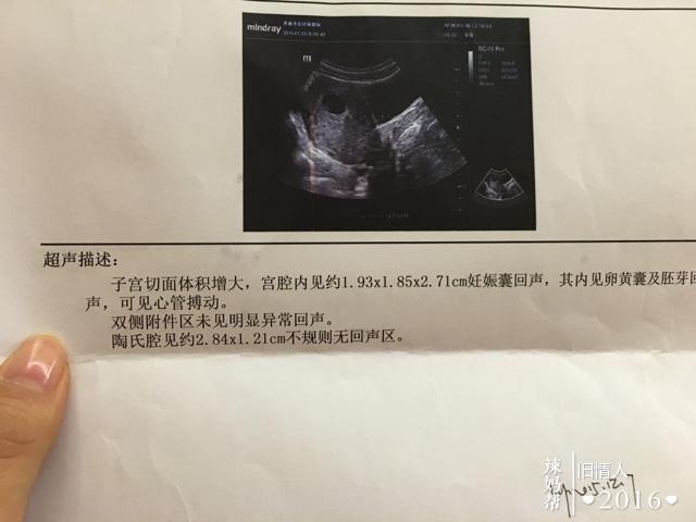 怀孕9周胚芽多大正常