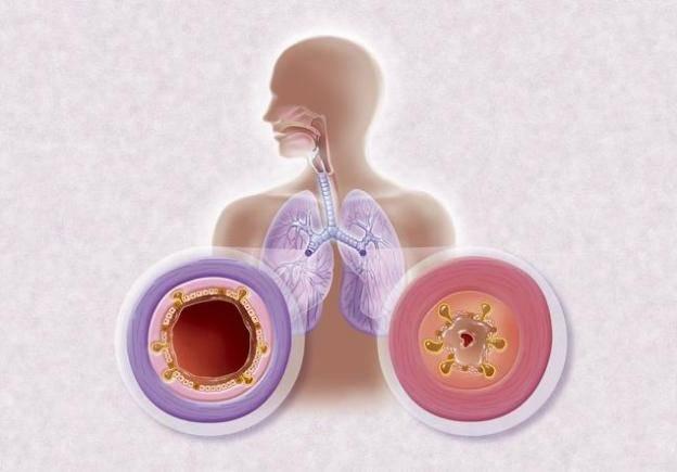 宝宝咳嗽有痰怎么办最有效