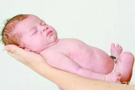 婴儿缺氧发育迟缓怎么办