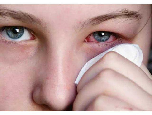 孩子为什么会得红眼病