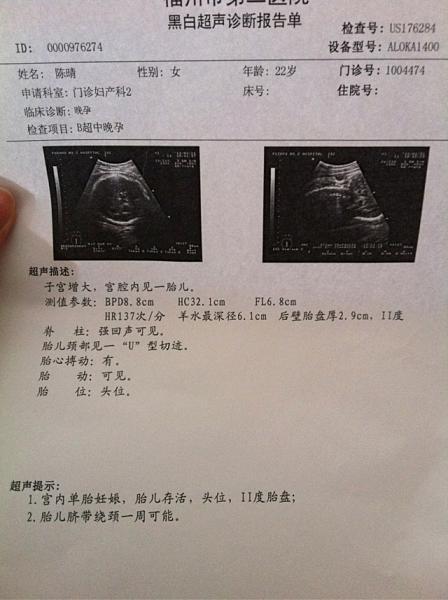 怀孕38周胎儿大小标准