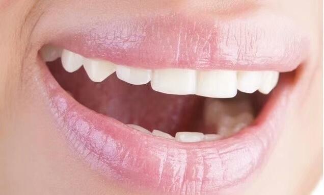 有哪些是婴幼儿常见口腔疾病