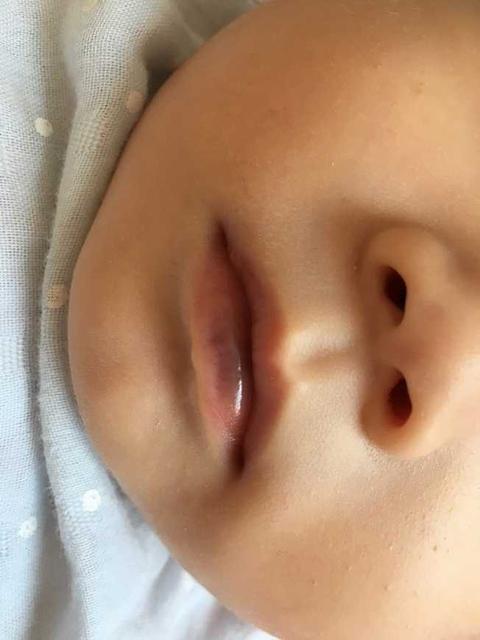 宝宝嘴唇发紫是怎么回事