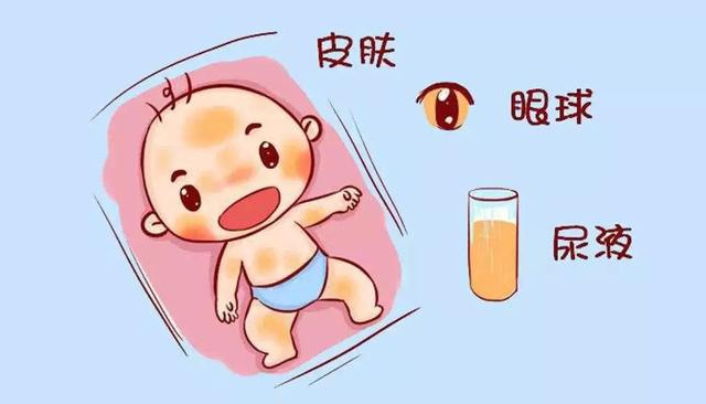 新生儿出现黄疸