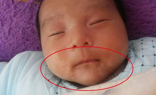 注意！宝宝出现以下任意三种症状即缺锌