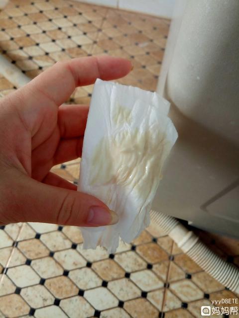 孕妇什么情况下需要打催产针