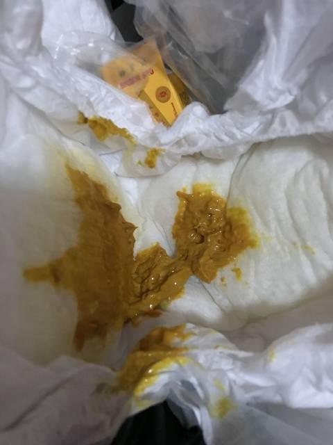 宝宝便秘怎么办快速排便小妙招