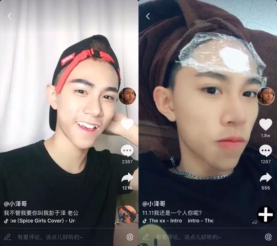 坐拥130w粉的"抖音版彭于晏",隆鼻失败却感动了所有人