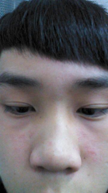 小儿过敏的原因是什么