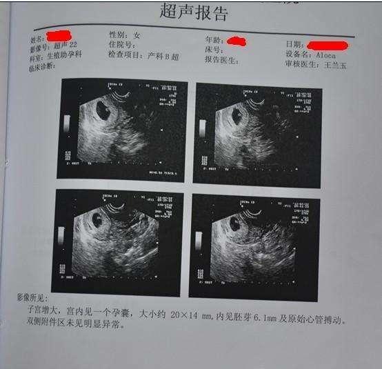 孕囊和胚胎的区别