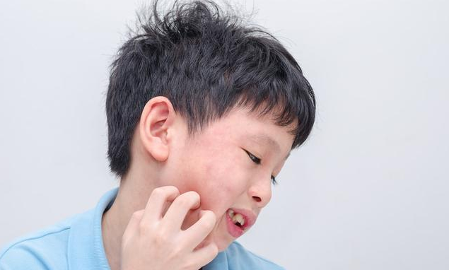 孩子是过敏体质怎么调理