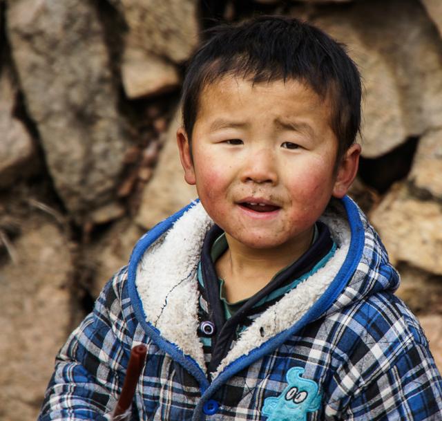 孩子总是流鼻涕不好怎么办